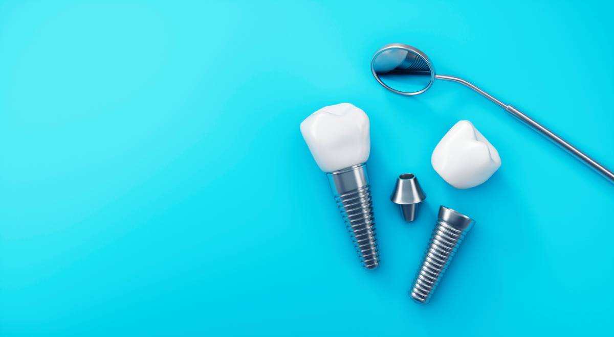 concept of dental implants maintenance