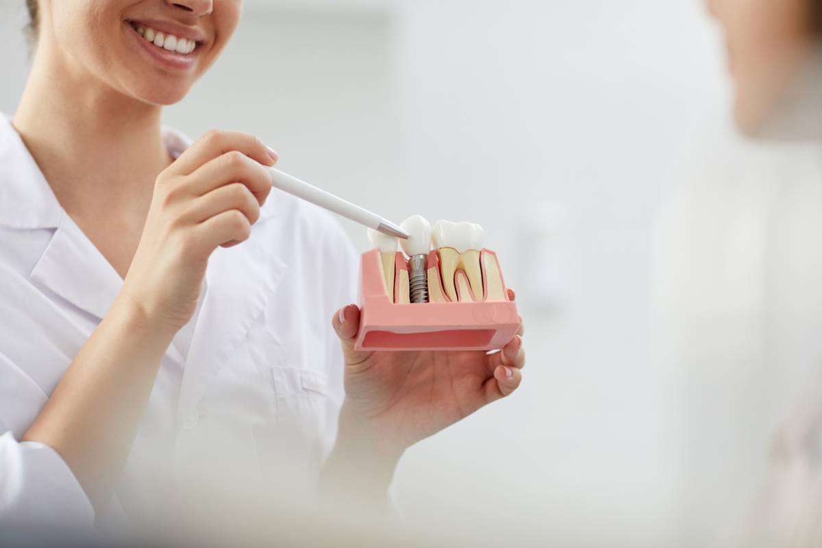 featured image for dental implants maintenance and care